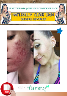 Naturally Clear Skin Secrets Revealed PDF EBOOK